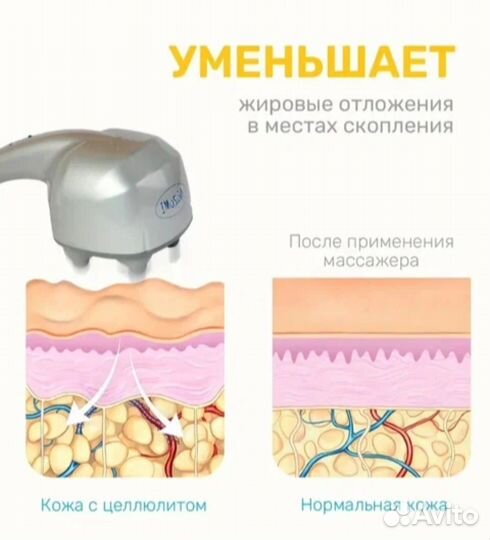 Массажер Нозоми мн-103 с ионизатором