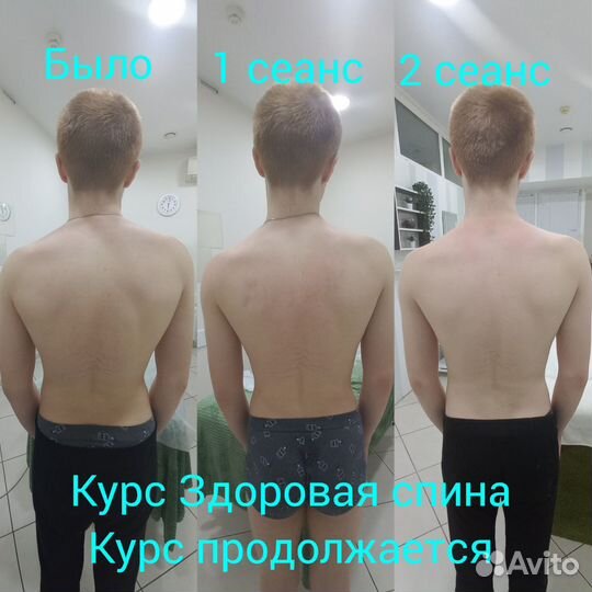 Массаж Кинезио, Здоровая спина, Остеобаланс