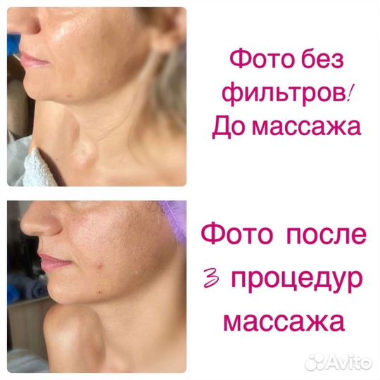 Классич. массаж тела лица, камни при боли точечный