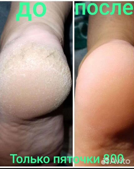 Маникюр, педикюр