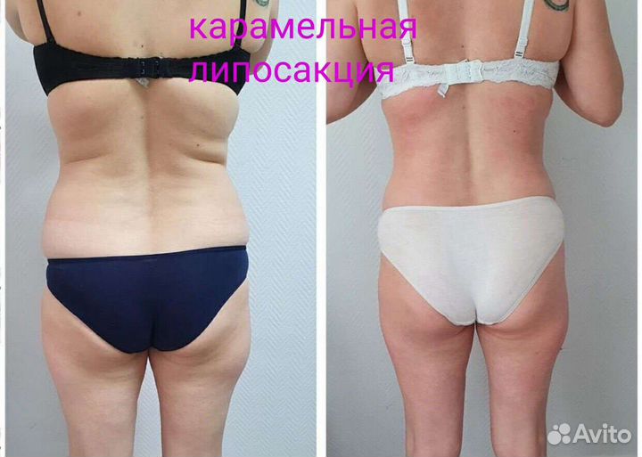 Массаж лица и тела. Коррекция фигуры