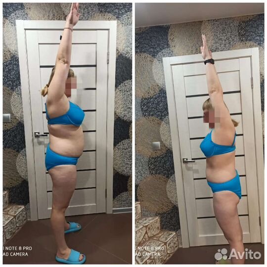 Кавитация, антицеллюлитный массаж,рф лифтинг