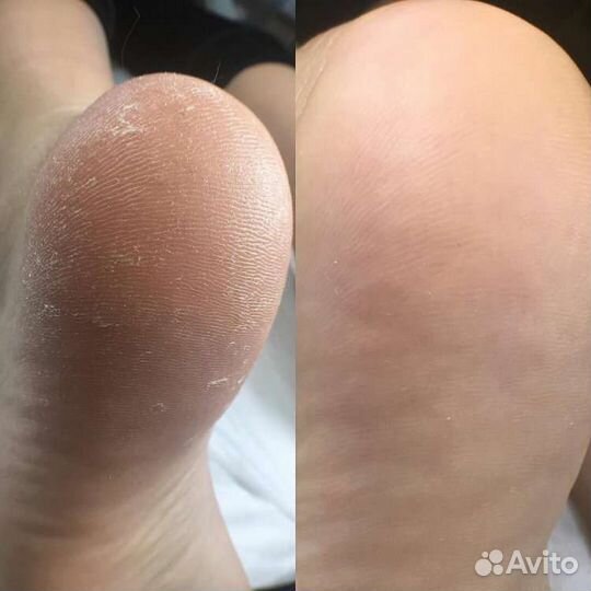 Педикюр Смарт,наращивание ногтей,маникюр