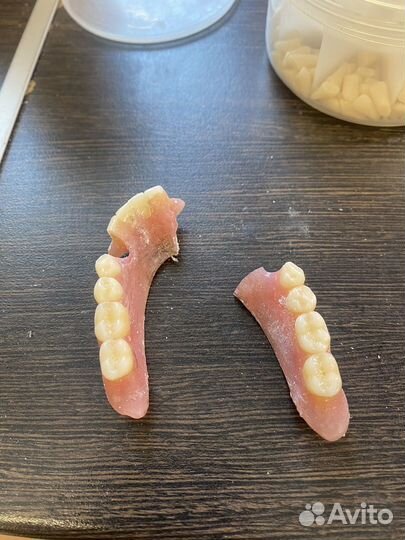 Починка зубных протезов