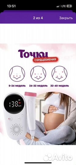 Фетальный допплер