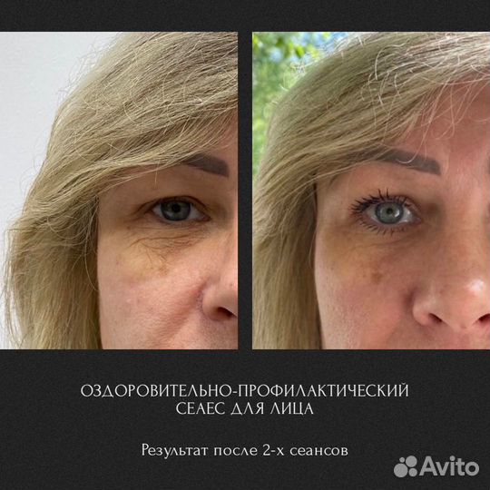 Оздоровительный массаж