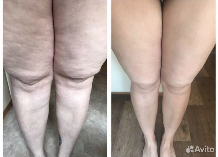 Массаж для женщин