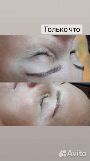 Аппаратная косметология