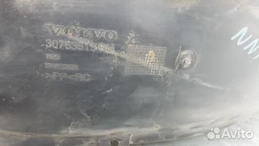 Защита арок (защита крыла, подкрылок) передняя пра