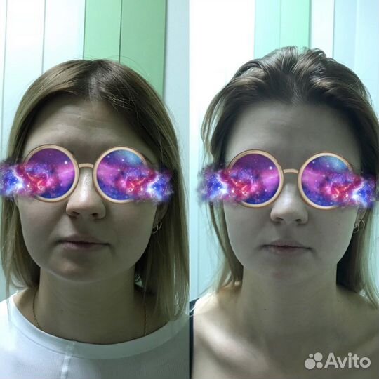 Холодная плазма