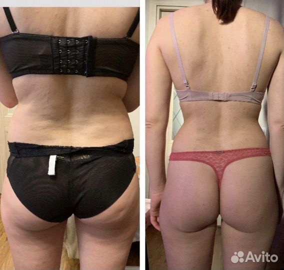 Антицеллюлитный массаж