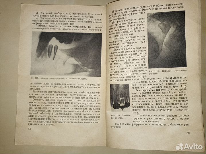 Рентгенодиагностика заболеваний лицевого черепа. 1