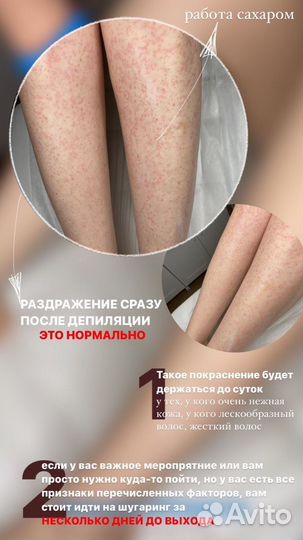 Мастер шугаринга