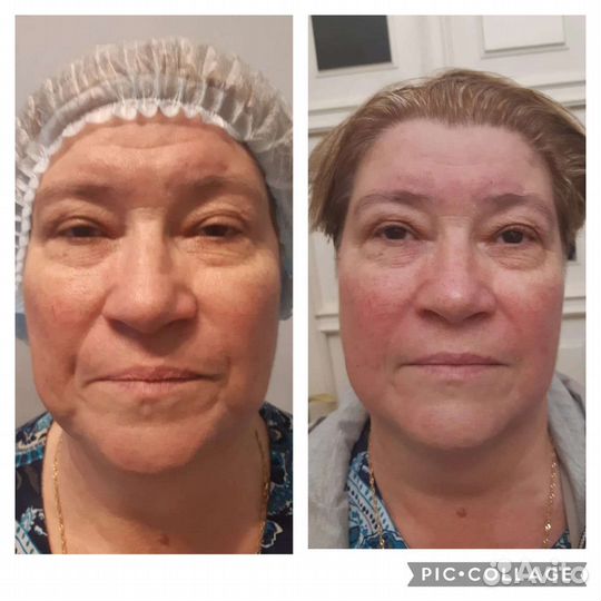 Массаж лица и тела