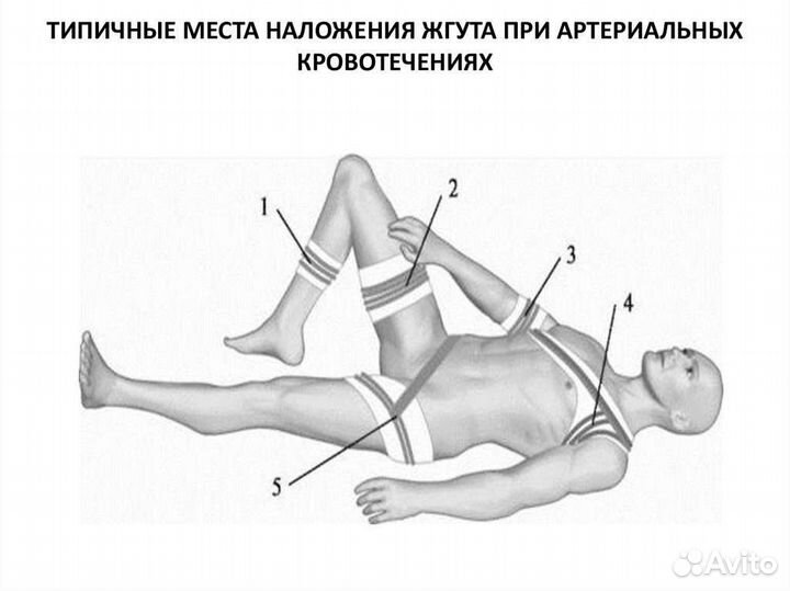 Жгут кровоостанавливающий. Эластичная трубка