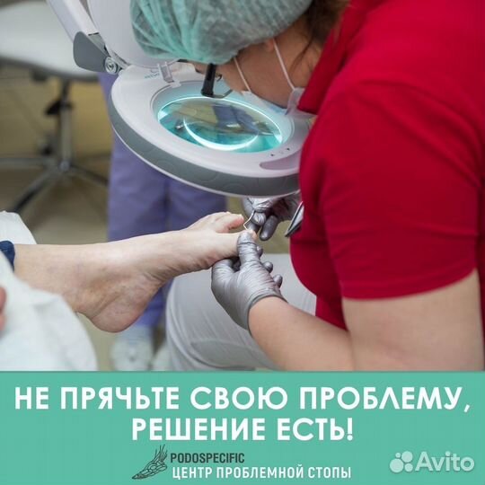 Услуги подолога, вросший ноготь