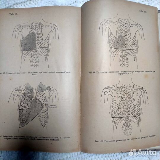 Старинная книга - Учебник клинических методов