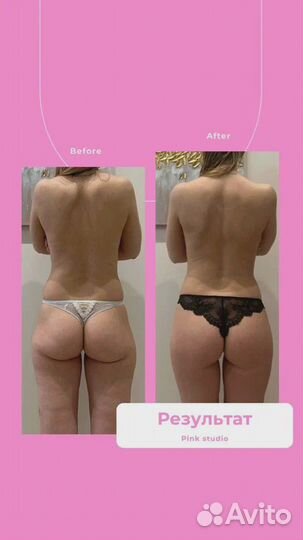 Массаж лимфодренажный / Опытный массажист