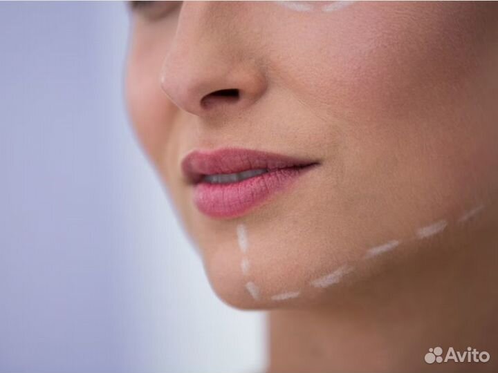 Смас лифтинг