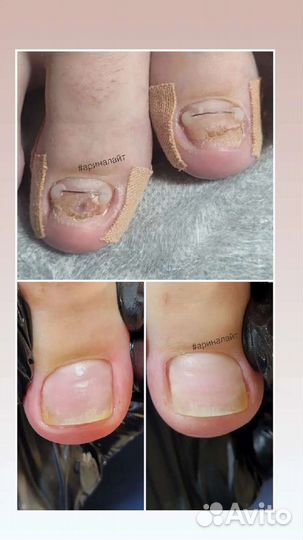 Подология Педикюр Мужской Женский Маникюр Гельлак