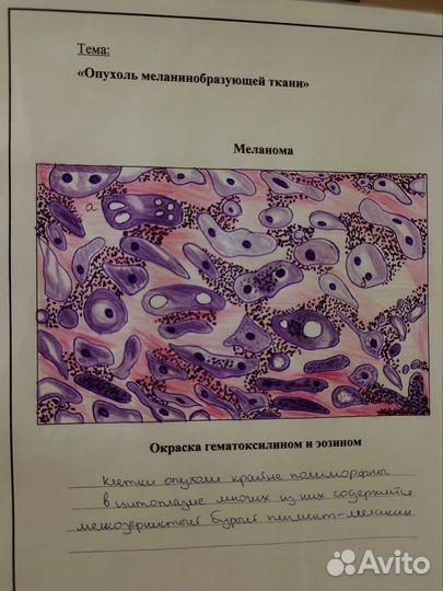 Пишу конспекты,лекции, рисунки
