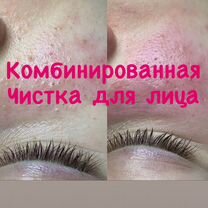Чистка лица, Видное