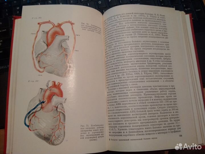 Книга по хирургии сердца (СССР)