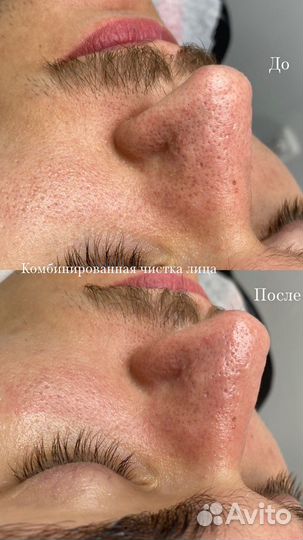 Услуги косметолога