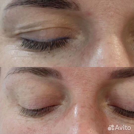 Холодная плазма