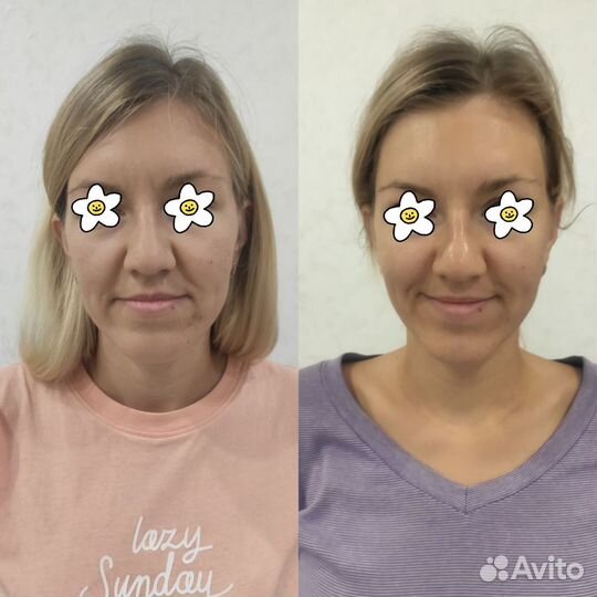 Услуги косметолога. Массаж лица