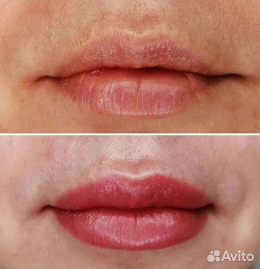 Наращивание