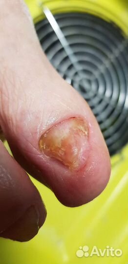 Подолог, педикюр, маникюр