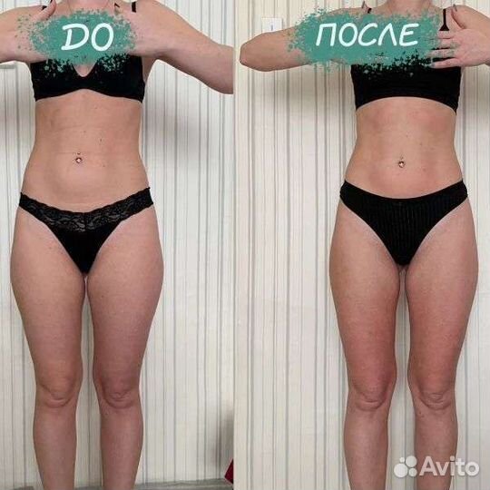 Вакуумный массаж. кавитация. миостимуляция