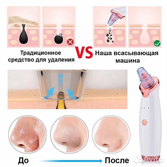 Вакуумный аппарат аппарат для чистки лица