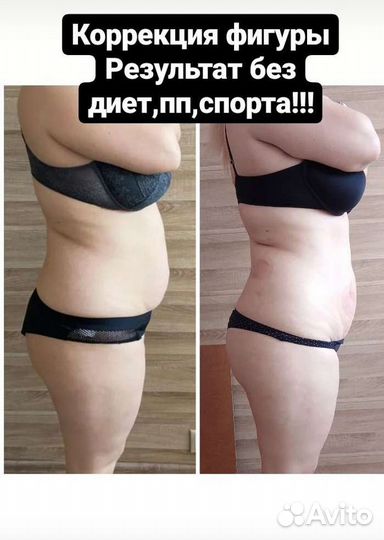 Массаж