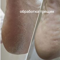 Педикюр любой сложности, Москва