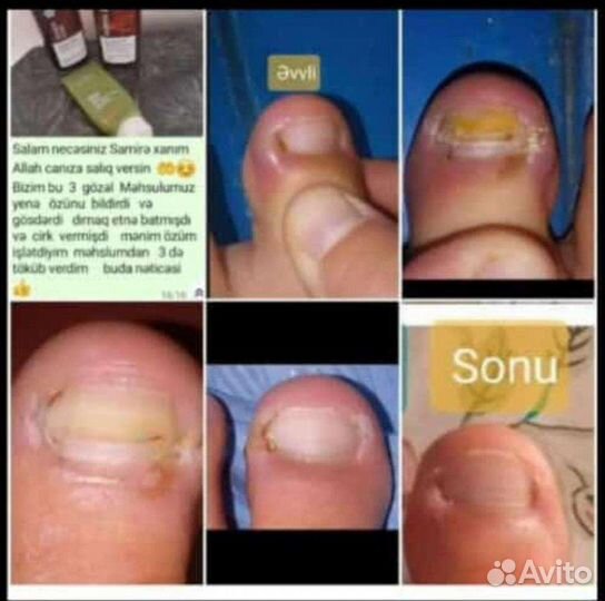 Сибирское здоровье