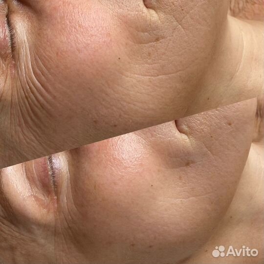 Косметолог / Массаж лица