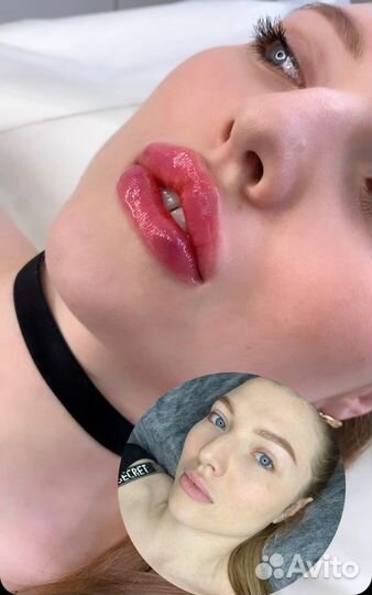 Консультация косметолога