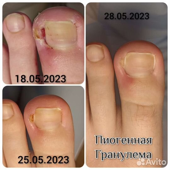 Подология;Педикюр, Маникюр; Наращивание ногтей