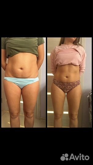 Антицеллюлитный массаж