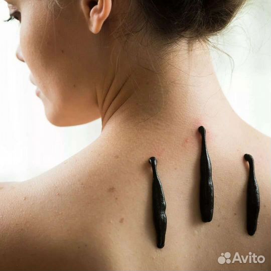 Купон на гирудотерапию