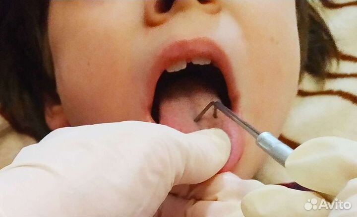 Логопед/Логомассаж/ Выезд/ Рыбацкое/Усть-Славянка