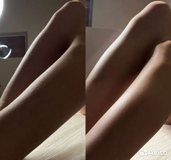 Шугаринг и восковая депиляция