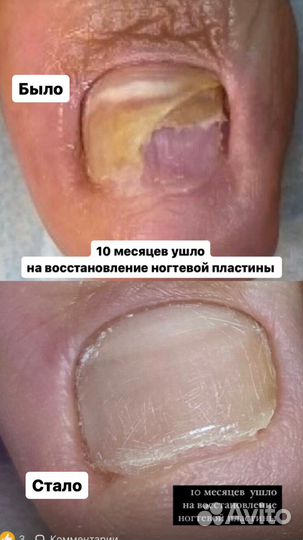 Подолог, изготовление стелек