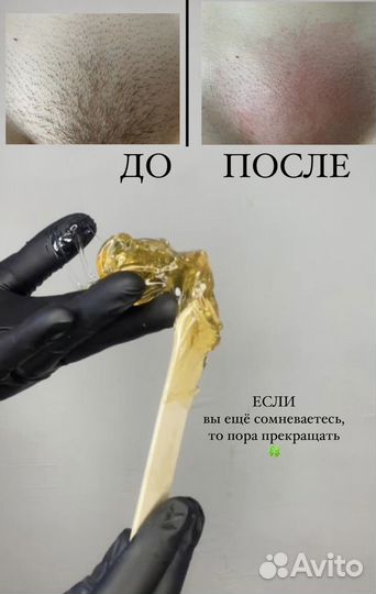 Шугаринг