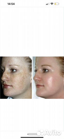 Пилинг mediderma ретиноловый