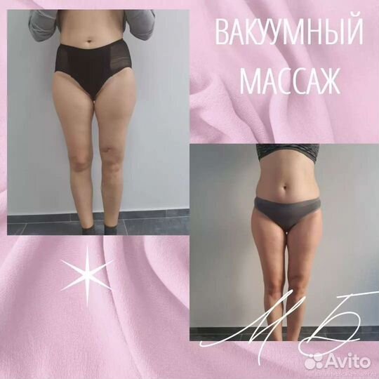 Косметолог, массаж, пилинг, чистка, аппарат массаж