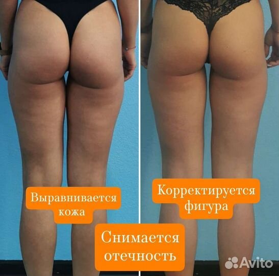 Аппаратный массаж /снижение веса, коррекция фигуры