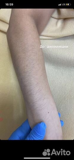 Модель на шугаринг депиляция